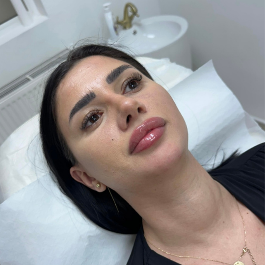 acid hialuronic si colagen