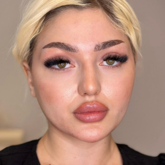 18
