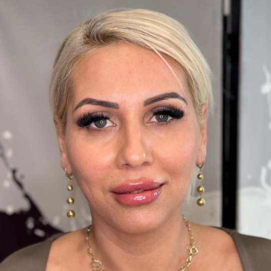 20