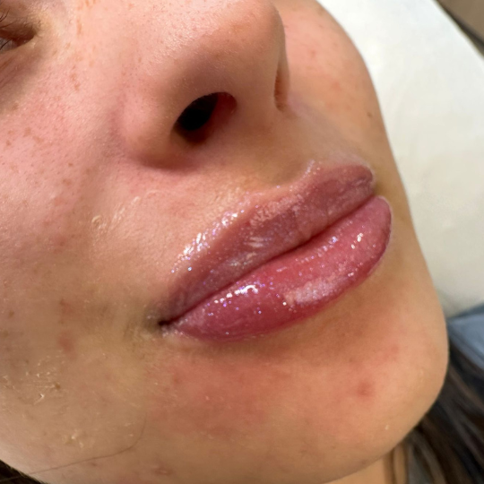 russian lips bucuresti