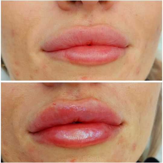 russian lips cluj
