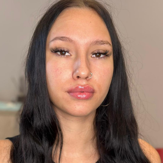 acid hialuronic premium bucuresti